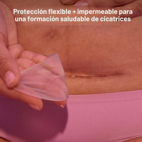 Frida Mom – Tiras de Silicona para Cicatriz de Cesárea (6 unidades)
